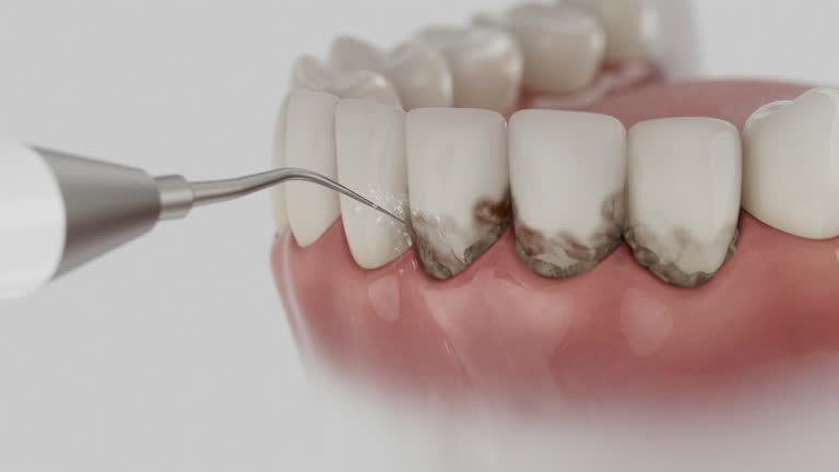 Trusted Dental Crowns And Bridges service in Baton Rouge, LA - Dentist Open Now